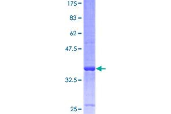 VAMP8 Protein (AA 1-100) (GST tag)