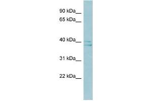 WB Suggested Anti-RAD51AP1 Antibody Titration:  0. (RAD51AP1 Antikörper  (Middle Region))