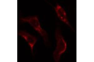 ABIN6274927 staining Hela cells by IF/ICC. (BCAS4 Antikörper)