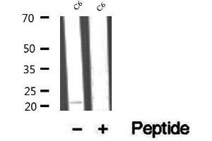 Western blot analysis of extracts of C6 cells, using RAP1B antibody. (RAP1B Antikörper  (C-Term))