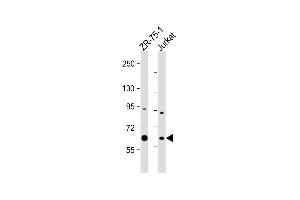 All lanes : Anti-M1D Antibody (Center) at 1:1000 dilution Lane 1: ZR-75-1 whole cell lysate Lane 2: Jurkat whole cell lysate Lysates/proteins at 20 μg per lane. (PPM1D Antikörper  (AA 183-212))