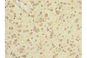 Immunohistochemistry (IHC) image for anti-Piezo-Type Mechanosensitive Ion Channel Component 1 (PIEZO1) (AA 2230-2420) antibody (ABIN7163444)