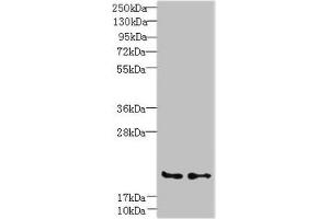 Western blot All lanes: C20orf27 antibody at 6 μg/mL Lane 1: HCT116 whole cell lysate Lane 2: MDA-MB-231 whole cell lysate Secondary Goat polyclonal to rabbit IgG at 1/10000 dilution Predicted band size: 20, 22 kDa Observed band size: 20 kDa (C2orf27A Antikörper  (AA 3-174))