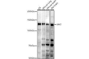 Western blot analysis of extracts of various cell lines, using J antibody (ABIN7268040) at 1:1000 dilution. (JAK2 Antikörper)