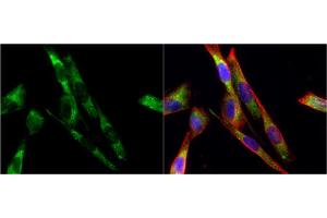 Immunofluorescence (IF) image for anti-Tyrosine Hydroxylase (TH) antibody (ABIN2855393)