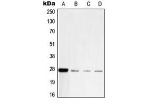 Western blot analysis of PGP9. (UCHL1 Antikörper  (C-Term))