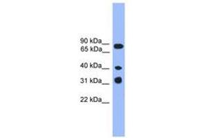 Image no. 1 for anti-Lymphocyte Transmembrane Adaptor 1 (LAX1) (C-Term) antibody (ABIN6745351) (LAX1 Antikörper  (C-Term))