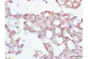 Formalin-fixed and paraffin embedded rat lung tissue labeled with Anti-PAX2 Polyclonal Antibody, Unconjugated (ABIN738951) at 1:200 followed by conjugation to the secondary antibody and DAB staining (PAX2A Antikörper)
