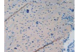 IHC-P analysis of Mouse Brain Tissue, with DAB staining. (MAPT Antikörper  (AA 92-400))