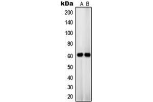 Western blot analysis of OCT3 expression in HT29 (A), JAR (B) whole cell lysates. (SLC22A8 Antikörper  (Center))