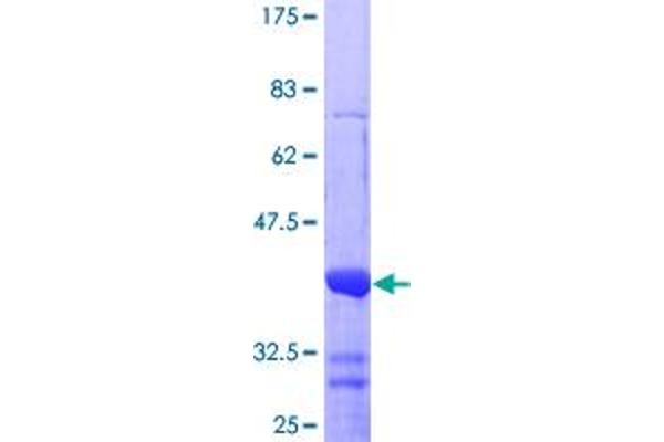 NR4A2 Protein (AA 71-170) (GST tag)