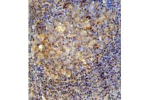 Immunohistochemistry analysis in formalin fixed and paraffin embedded human tonsil tissue reacted with CD10 / Neprilysin Antibody (Center) followed by peroxidase conjugation of the secondary antibody and DAB staining. (MME Antikörper  (Middle Region))