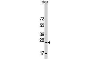 Western blot analysis of CD8A polyclonal antibody  in HeLa cell line lysates (35 ug/lane). (CD8 alpha Antikörper  (N-Term))