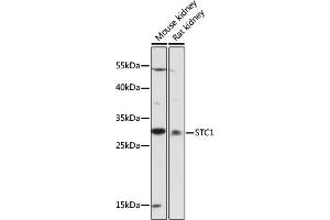 Western blot analysis of extracts of various cell lines, using STC1 antibody (ABIN7270583) at 1:1000 dilution. (Stanniocalcin 1 Antikörper  (AA 18-247))