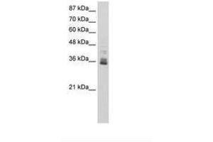 Image no. 1 for anti-Zinc Finger Protein 197 (ZNF197) (N-Term) antibody (ABIN6736240) (ZNF197 Antikörper  (N-Term))