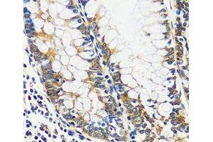 Immunohistochemistry of paraffin-embedded Human colon using CCDC124 Polyclonal Antibody at dilution of 1:100 (40x lens). (CCDC124 Antikörper)