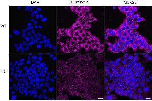 Immunocytochemical staining of HeLa cells using Huntingtin antibody (ABIN7799005), 1:1,000), Top panel: wild-type (WT), Bottom panal: Huntingtin shRNA knockdown (KD). (Rekombinanter Huntingtin Antikörper)