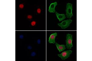 ABIN6256094 and ABIN6267526 staining Hela cells(4h of LPS treatment) by IF/ICC. (GATA4 Antikörper  (pSer105))