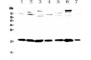 Western blot analysis of HE4 using anti-HE4 antibody .