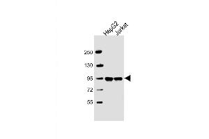 Western Blot at 1:2000 dilution Lane 1: HepG2 whole cell lysate Lane 2: Jurkat whole cell lysate Lysates/proteins at 20 ug per lane. (PPFIBP1 Antikörper  (AA 588-617))