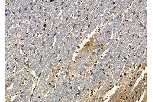 ABIN6262437 and ABIN6278874 at 1/100 staining rat brain tissue by IHC-P. (CARD18 Antikörper  (C-Term))
