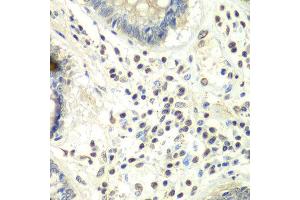 Immunohistochemistry of paraffin-embedded human colon using PRMT5 antibody at dilution of 1:100 (x40 lens). (PRMT5 Antikörper)