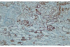 Immunohistochemistry (IHC) image for anti-Napsin A Aspartic Peptidase (NAPSA) (N-Term) antibody (ABIN7598894) (NAPSA Antikörper  (N-Term))