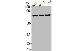 Western Blot analysis of PC12 MCF7 Jurkat cells using AKAP 95 Polyclonal Antibody (AKAP8 Antikörper  (Internal Region))