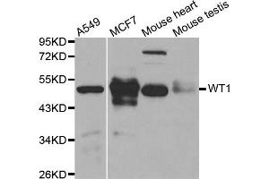 Western blot analysis of extracts of various cell lines, using WT1 antibody. (WT1 Antikörper)