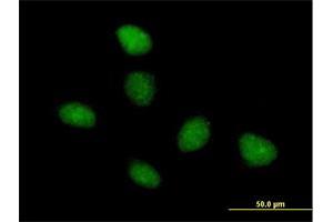 Immunofluorescence of purified MaxPab antibody to TAF15 on HeLa cell. (TAF15 Antikörper  (AA 1-592))