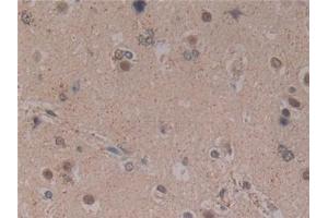 Detection of MFAP2 in Human Brain Tissue using Polyclonal Antibody to Microfibrillar Associated Protein 2 (MFAP2) (MFAP2 Antikörper  (AA 6-162))