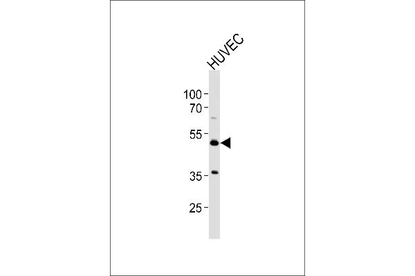 Prostacyclin Receptor Antikörper