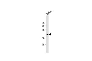 Anti-ST3GAL5 Antibody (C-term) at 1:1000 dilution + Jurkat whole cell lysate Lysates/proteins at 20 μg per lane. (ST3GAL5 Antikörper  (AA 389-418))