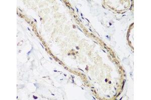 Immunohistochemistry of paraffin-embedded Human colon using CAV3 Polyclonal Antibody at dilution of 1:200 (40x lens).