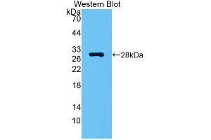 Western blot analysis of the recombinant protein. (CA2 Antikörper  (AA 1-260))