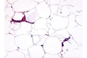 Immunohistochemical staining of Adipocytes using anti- GPR109B antibody ABIN122203