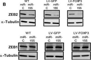 miR-155 and FOXP3 down regulate endogenous ZEB2 in human breast cancer cells resulting in altered levels of EMT markers Vimentin and E-cadherin(A) Relative abundance of ZEB2 and ZEB1 protein in WT, GFP or FOXP3 overexpressing BT549 cells transfected with miR-155 or miR-control. (alpha Tubulin Antikörper  (Internal Region))
