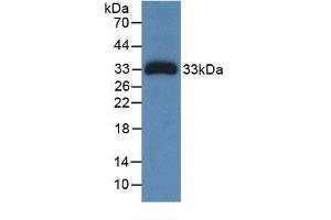 Detection of Recombinant Ceruloplasmin, Human using Monoclonal Antibody to Ceruloplasmin (CP) (Ceruloplasmin Antikörper  (AA 789-1065))