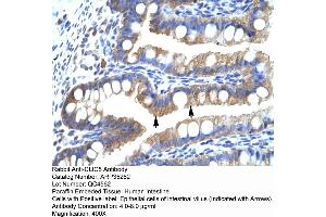 Human Intestine (CLIC5 Antikörper  (Middle Region))
