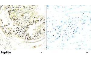 Immunohistochemistry analysis of paraffin-embedded human testis tissue using DYNLRB2 polyclonal antibody . (DYNLRB2 Antikörper)