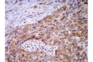 Immunohistochemistry (IHC) image for anti-Progesterone Receptor Membrane Component 1 (PGRMC1) (AA 1-195) antibody (ABIN5873919) (PGRMC1 Antikörper  (AA 1-195))