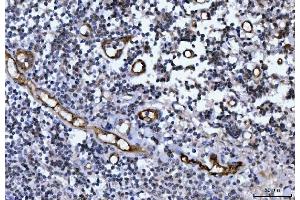 IHC analysis of Von Willebrand Factor/VWF using anti-Von Willebrand Factor/VWF antibody (ABIN7599909). (VWF Antikörper  (AA 1287-2770))