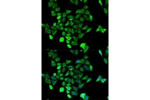 Immunofluorescence analysis of HeLa cell using KCNN4 antibody. (KCNN4 Antikörper  (AA 288-427))