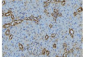 ABIN6272875 at 1/100 staining Mouse kidney tissue by IHC-P. (CAMSAP2 Antikörper  (C-Term))