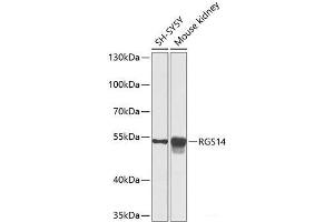 Western blot analysis of extracts of various cell lines using RGS14 Polyclonal Antibody at dilution of 1:1000. (RGS14 Antikörper)