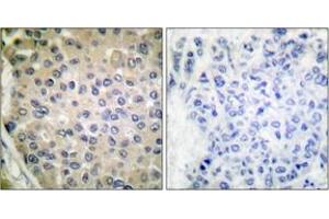 Immunohistochemistry (IHC) image for anti-Protein Phosphatase 1, Regulatory (Inhibitor) Subunit 14A (PPP1R14A) (pThr38) antibody (ABIN2888390) (CPI-17 Antikörper  (pThr38))