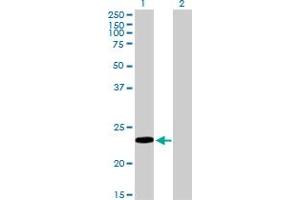 Western Blot analysis of RBP4 expression in transfected 293T cell line by RBP4 monoclonal antibody (M01), clone 1E9.
