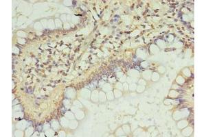 Immunohistochemistry of paraffin-embedded human small intestine tissue using ABIN7151719 at dilution of 1:100 (ZC3H12A Antikörper  (AA 1-260))