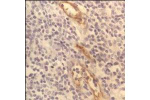 CD62P (P-Selectin) – ABIN118767 - Human tonsil showing capillary endothelium. (P-Selectin Antikörper)