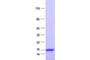Validation with Western Blot